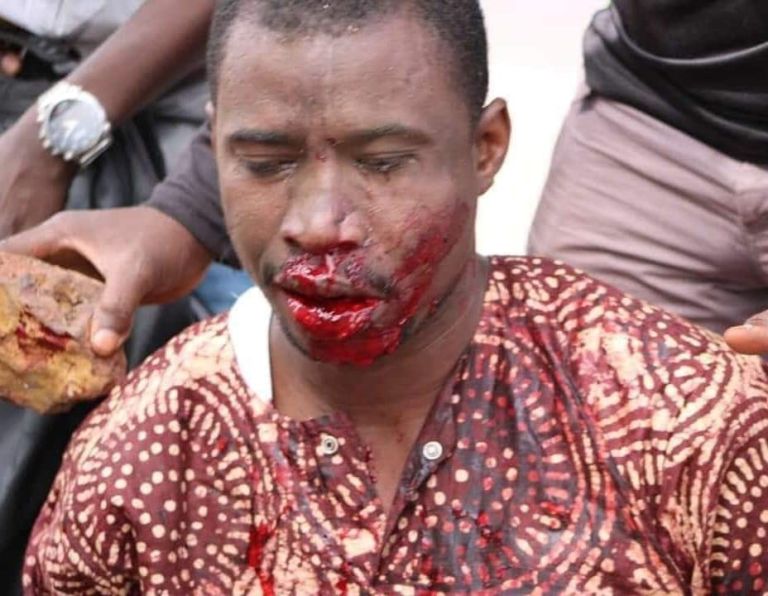 From one man losing almost all his teeth to Abdou Njie’s arrest, New Gambia’s dark day
