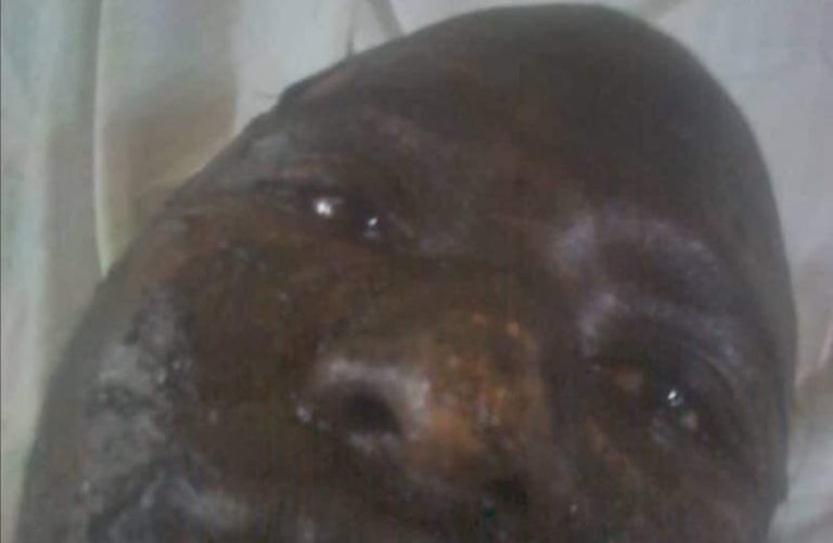 ‘He’s a Senegalese’: Government pushes back at ‘malicious’ allegations fisherman bathed with gasoline and set ablaze by Chinese fishermen is a Gambian