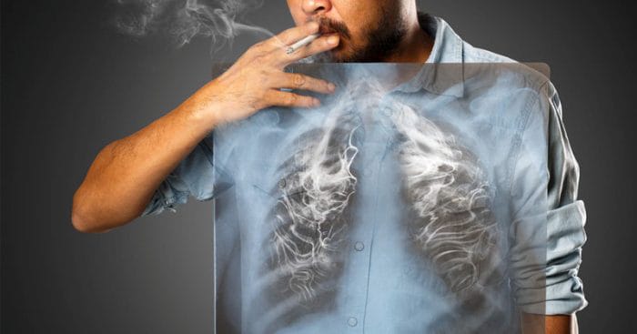 Six common diseases attributable to smoking and what The Gambia is doing about it